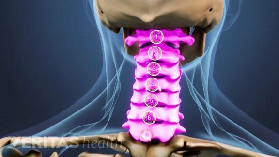 tratamentul coloanei vertebrale și lombare durere în partea stângă a spatelui la mișcare